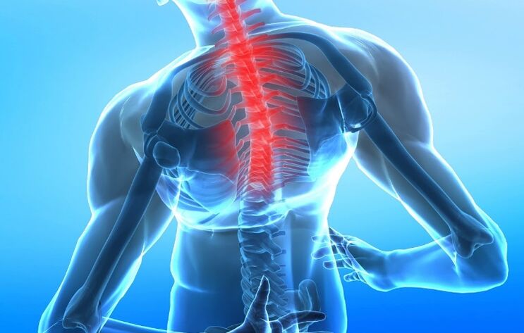 poškodenie krčnej chrbtice s osteochondrózou