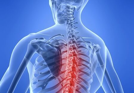 osteochondróza hrudnej chrbtice