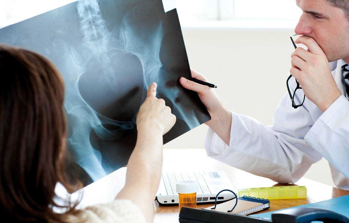 lekári skúmajúci röntgenové vyšetrenie na artrózu bedrového kĺbu