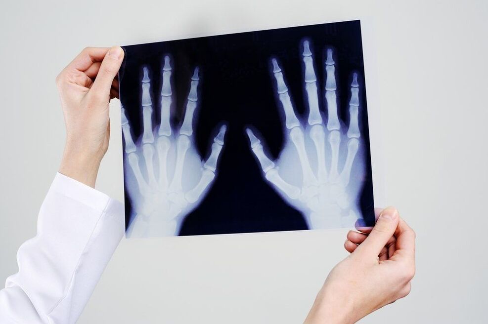 diagnostika kĺbov ruky